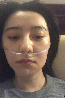 明星网红高原反应呕吐,呕吐背后的健康警示