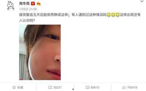 你爆料我吃瓜短剧免费观看,免费观看“我吃瓜”背后的秘密