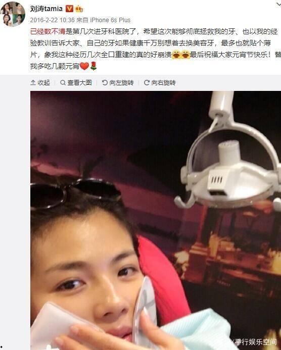 明星网红全是假牙吗,假牙真相大揭秘