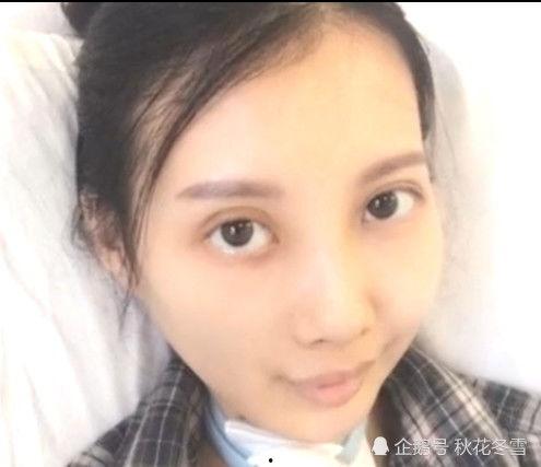 哪些明星网红有癌症,那些勇敢对抗癌症的明星网红