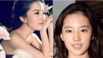 明星网红牙贴面图片,美丽笑容的秘密武器